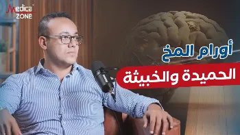 كل ما تحتاج معرفته عن أورام المخ